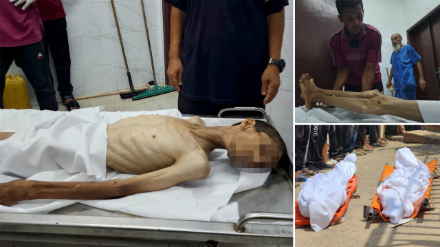 gazzede yetersiz beslenme nedeniyle 30 yasindaki filistinli hayatini kaybetti vR1BUs89