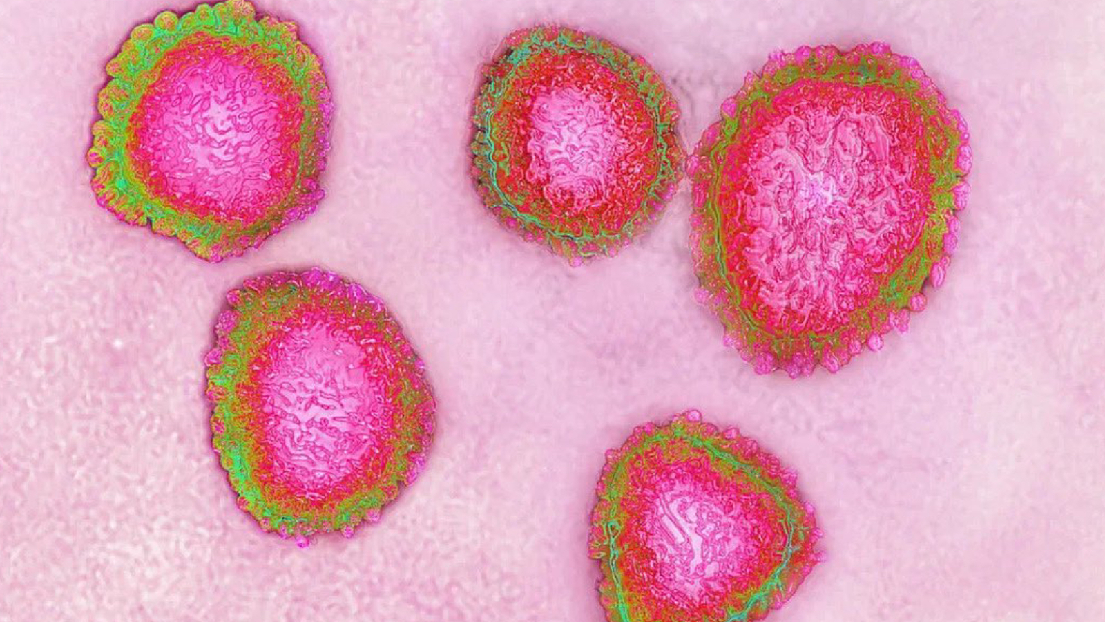 prof dr ceyhan uyariyor covid azalma noktasinda degil her yil artiyor turkiyede asisi yok ij3AlNBM